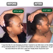 The Ultimate Hair Growth Set for Textured Hair