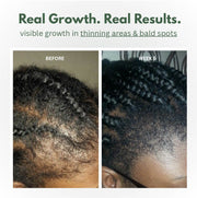 Scalp Serum Batana