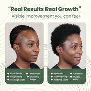 Batana Hair Growth Oil