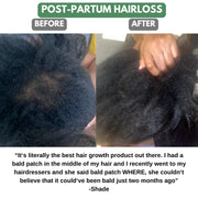 The Ultimate Hair Growth Set for Textured Hair